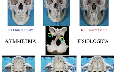 Accrescimento cranio-posturale asimmetrico e riequilibrio funzionale