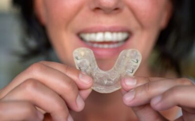 Bite dentale: non solo per il bruxismo